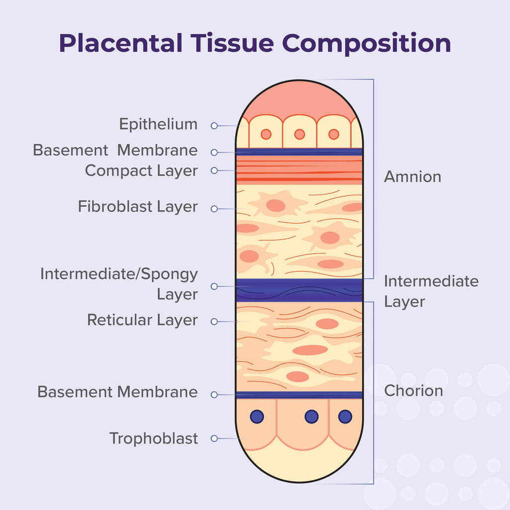 Amchoplast Placental Tissue Allograft